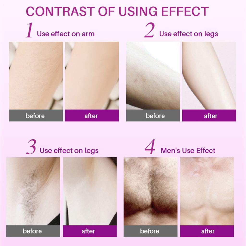 Hair Inhibitor, Hair Removal Spray, Painless Hair Growth Stopping Spray, Natural Ingredients, Non-irritating Hair Removal Spray