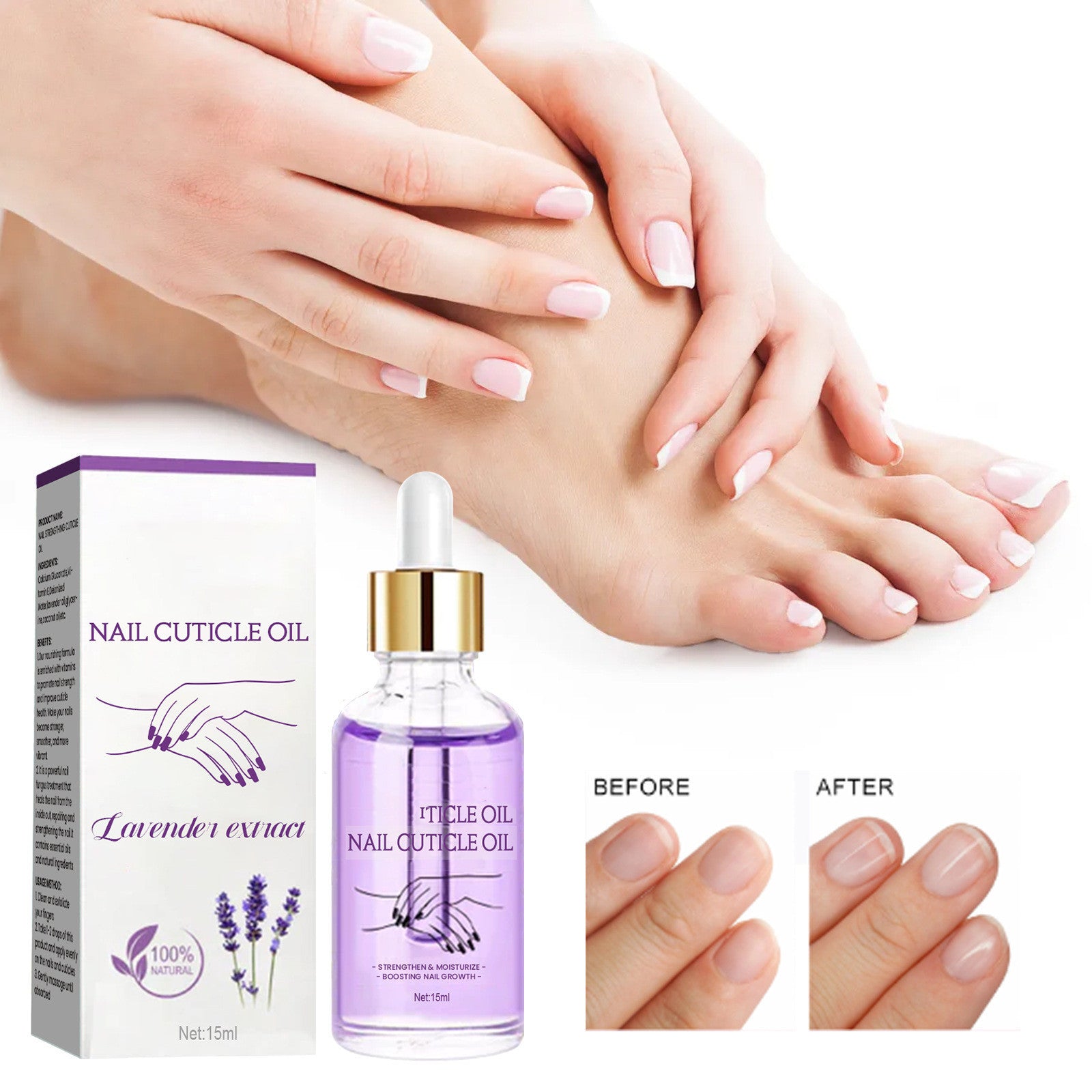 Nail Strengthening Cuticle Oil Repair Onychomycosis