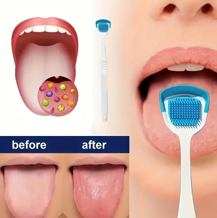 A Soft And Gentle Adult Tongue Brush That Effectively Removes Bad Breath, Effectively Removes Plaque, Freshens Breath, And Cares For Gum Health - Random Color